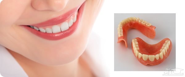  دندان مصنوعی