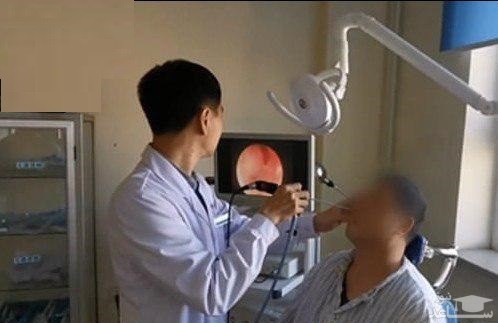 رشد عجیب دندان در بینی مرد ۳۰ ساله