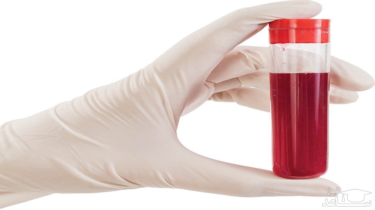 علایمی که می‌گویند گردش خون شما مشکل دارد