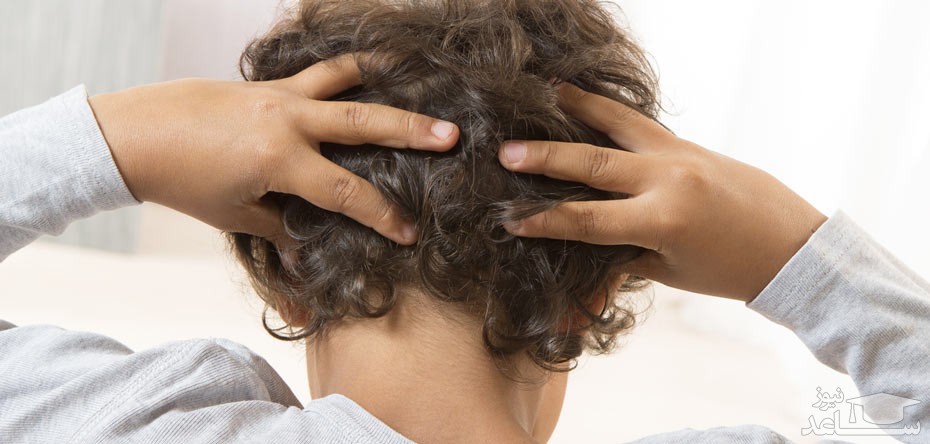 علایم وجود شپش در موی سر کودکان