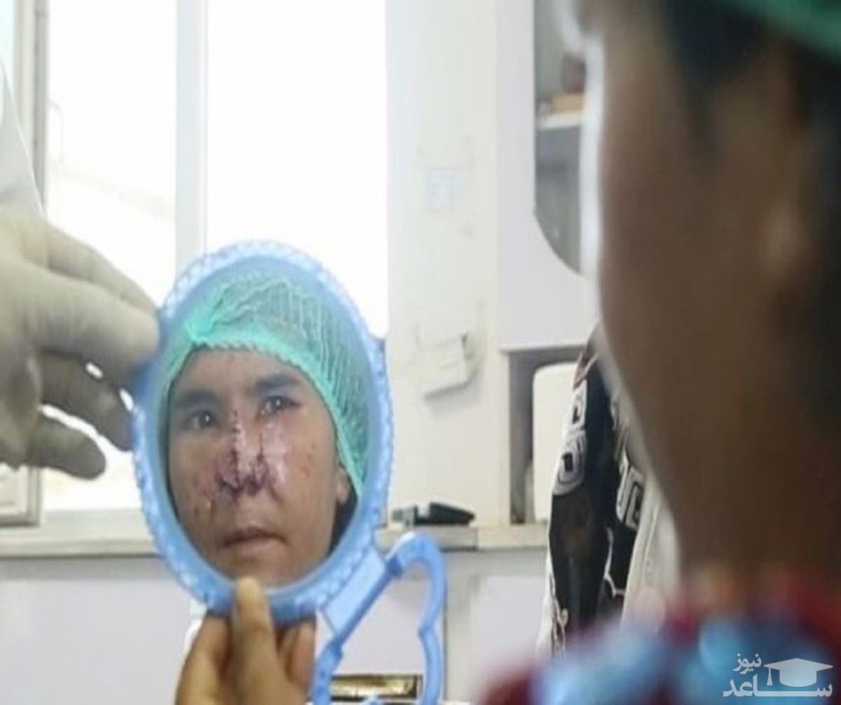 (فیلم +16) مرد افغان بینی زنش را بُرید