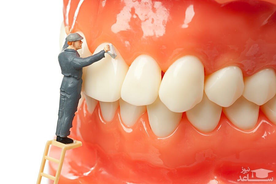 درمان تغییر رنگ دندان چیست؟