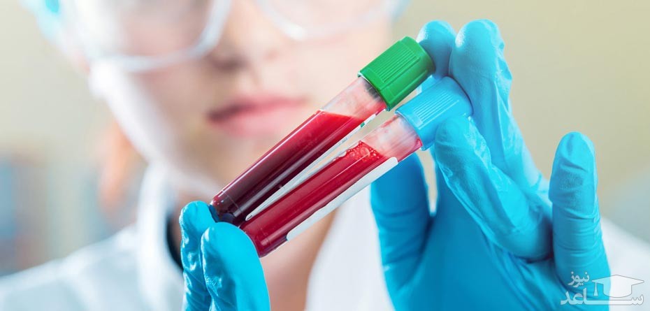 سونوگرافی NT و اولین مرحله غربالگری در دوران بارداری