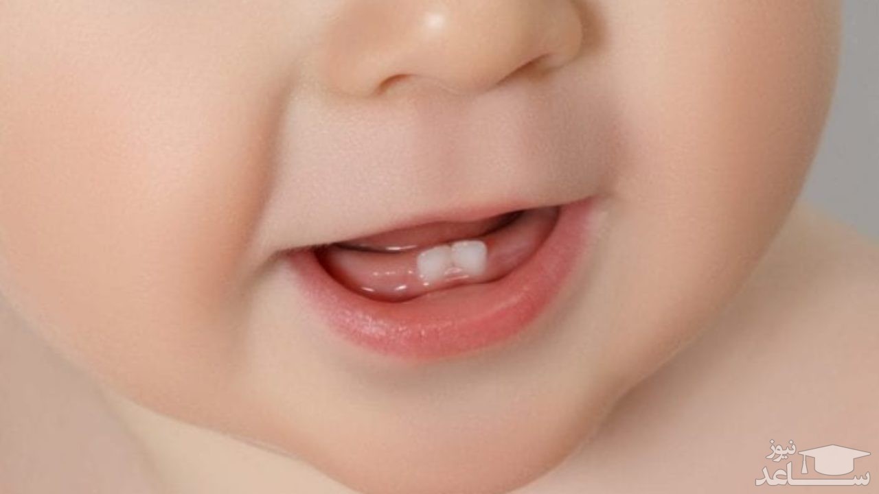 دندان نوزاد