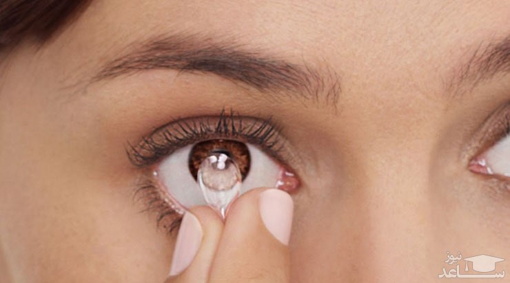 آلرژی چشمی چیست؟