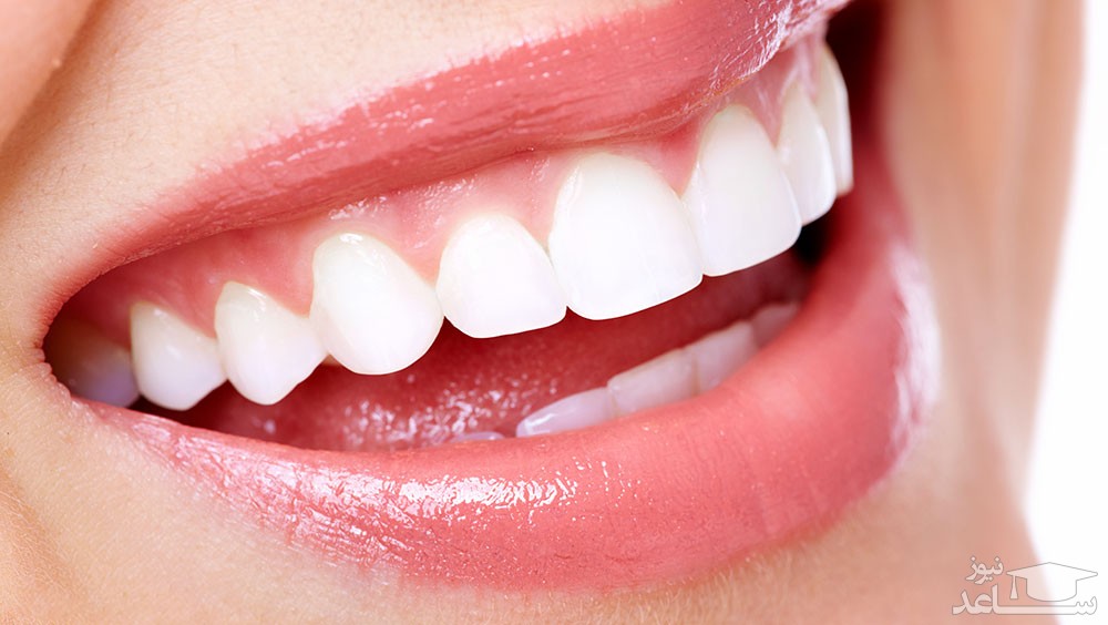 بدترین مواد غذایی برای دندان چیست؟
