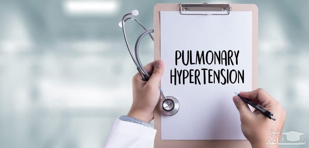 میزان و نحوه مصرف سلکسی پگ