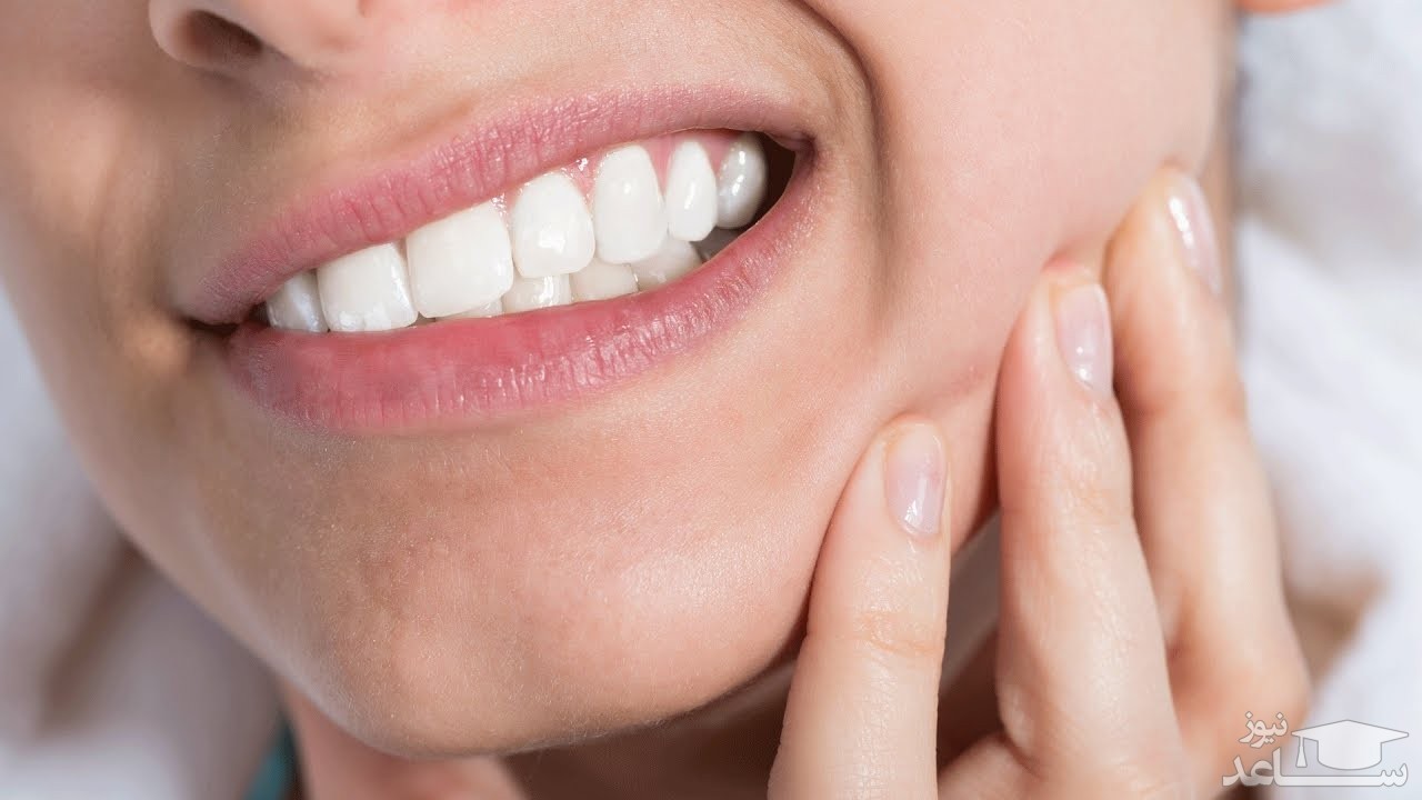 از عوارض لمینت دندان و معایب آن آگاهی دارید؟