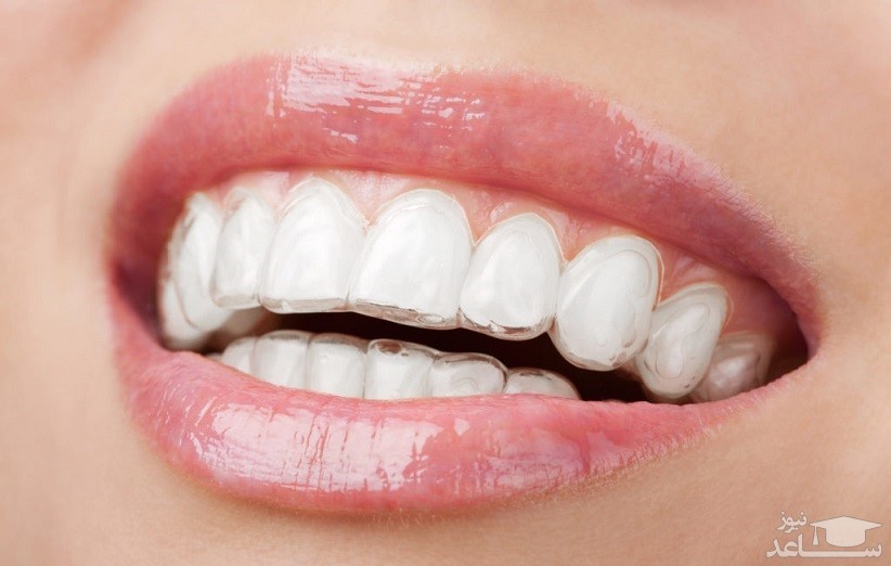 دلایل دچار شدن به درد دندان در دوره بارداری چیست؟