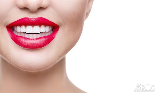 چند روش برای درمان فاصله بین دندان ها