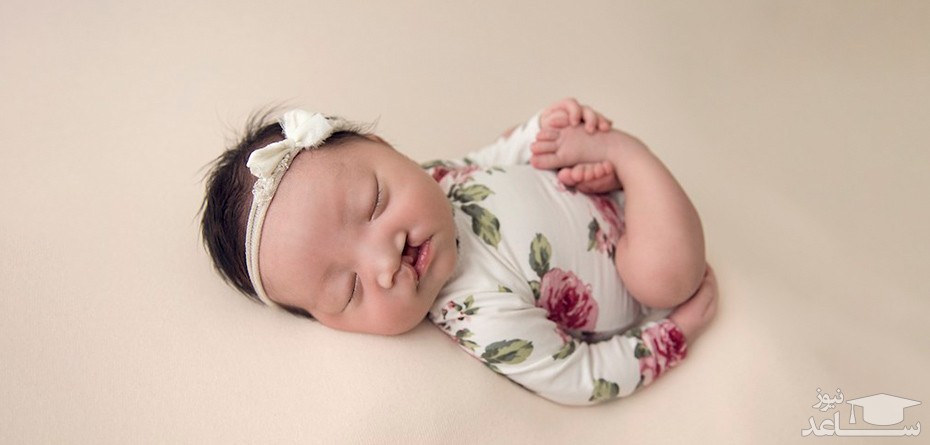 دلایل شکاف لب و کام در کودکان