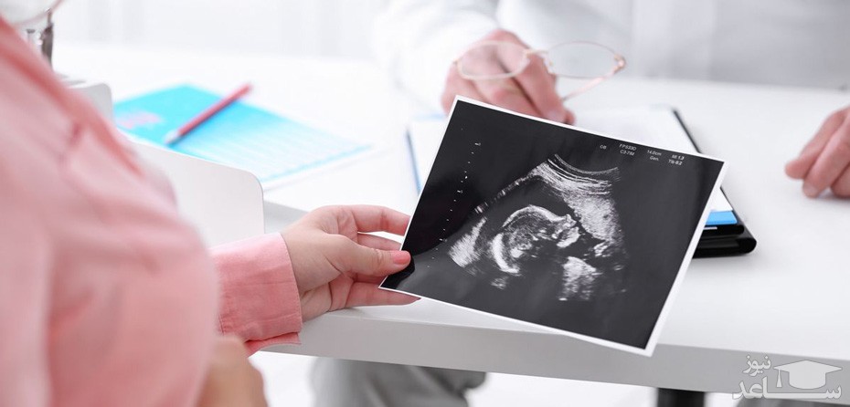 شرایط و زمان انجام  سونوگرافی ان تی NT در بارداری