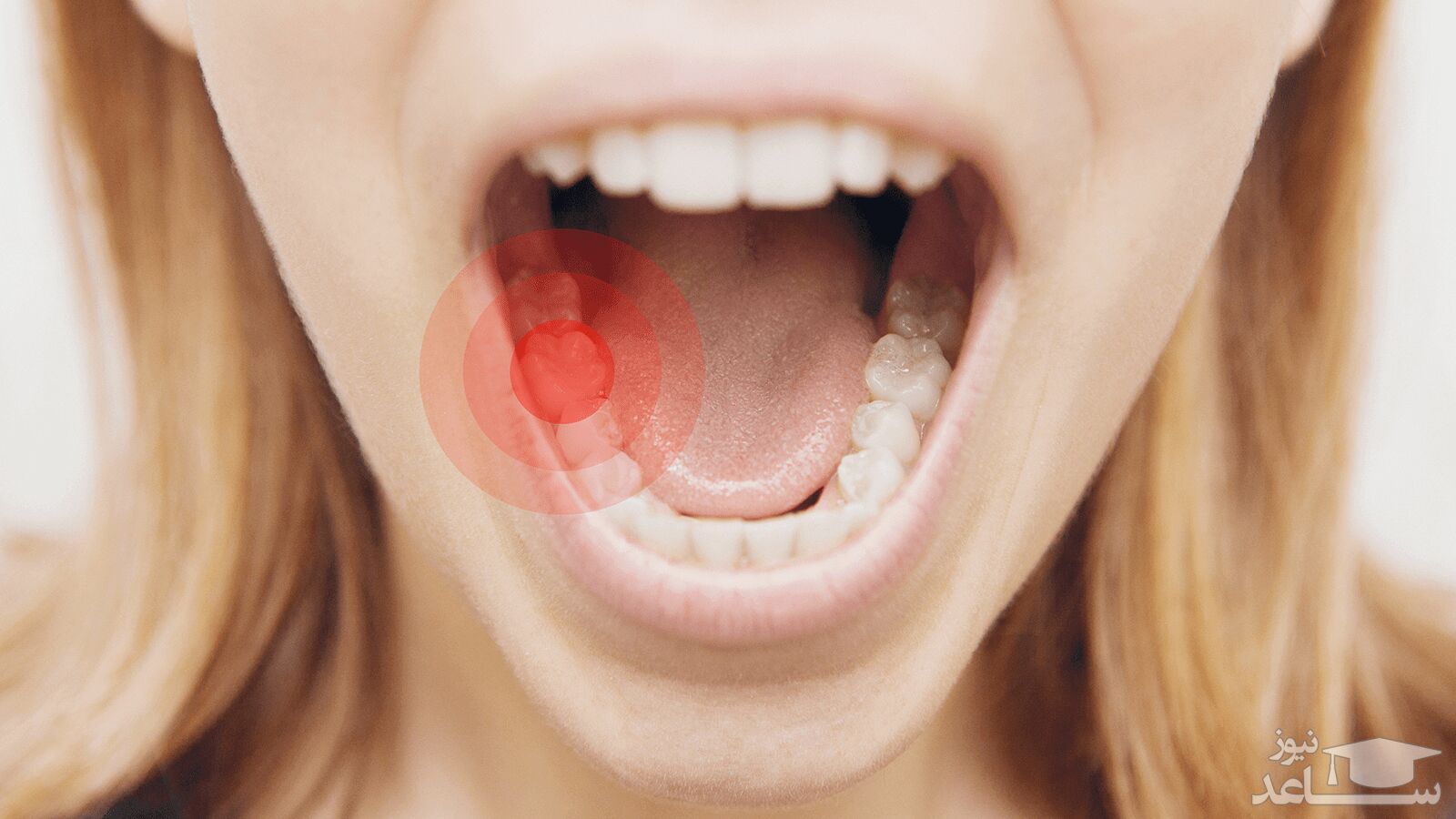 9 روش خانگی برای رفع درد دندان