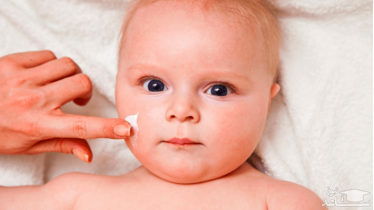 درمان‌های خانگی برای خشکی پوست در کودکان