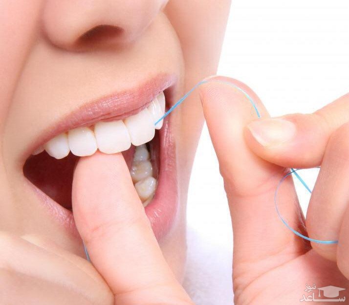 عوارض و فواید نخ دندان چیست؟