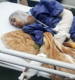 حمله سگ های بدون صاحب به طاها 11 ساله در شهرک زینبیه تهران +عکس دلخراش