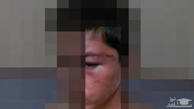 شکنجه پسر12 ساله در اتاق وحشت! / پدرش با شکنجه او را تا یک قدمی مرگ پیش برد