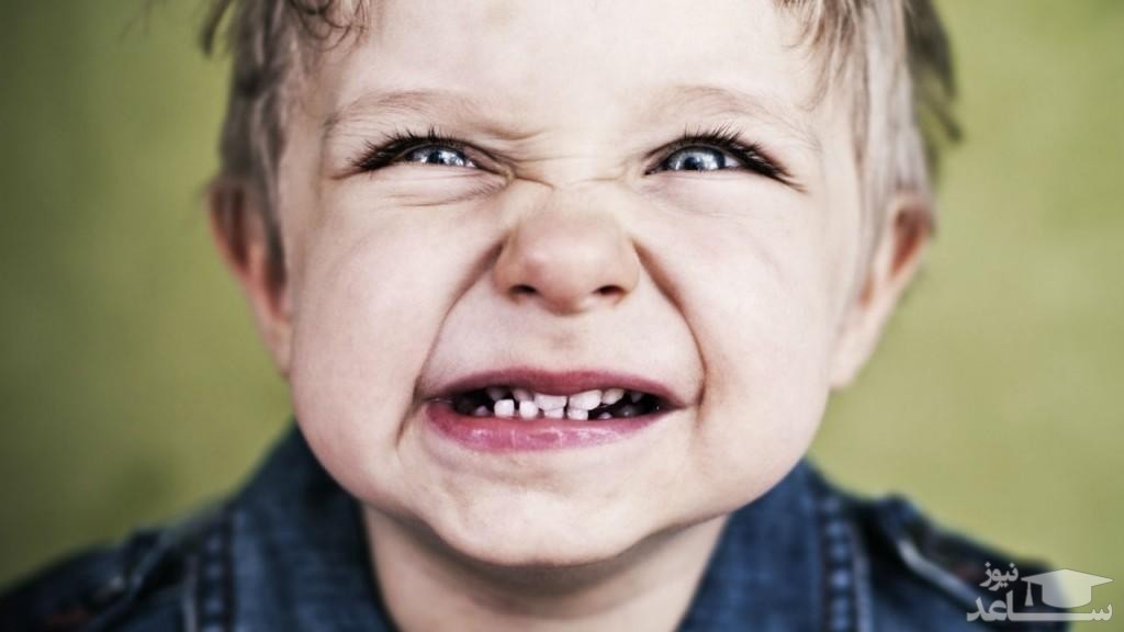 عواملی که باعث دندان قروچه در کودک میشود !