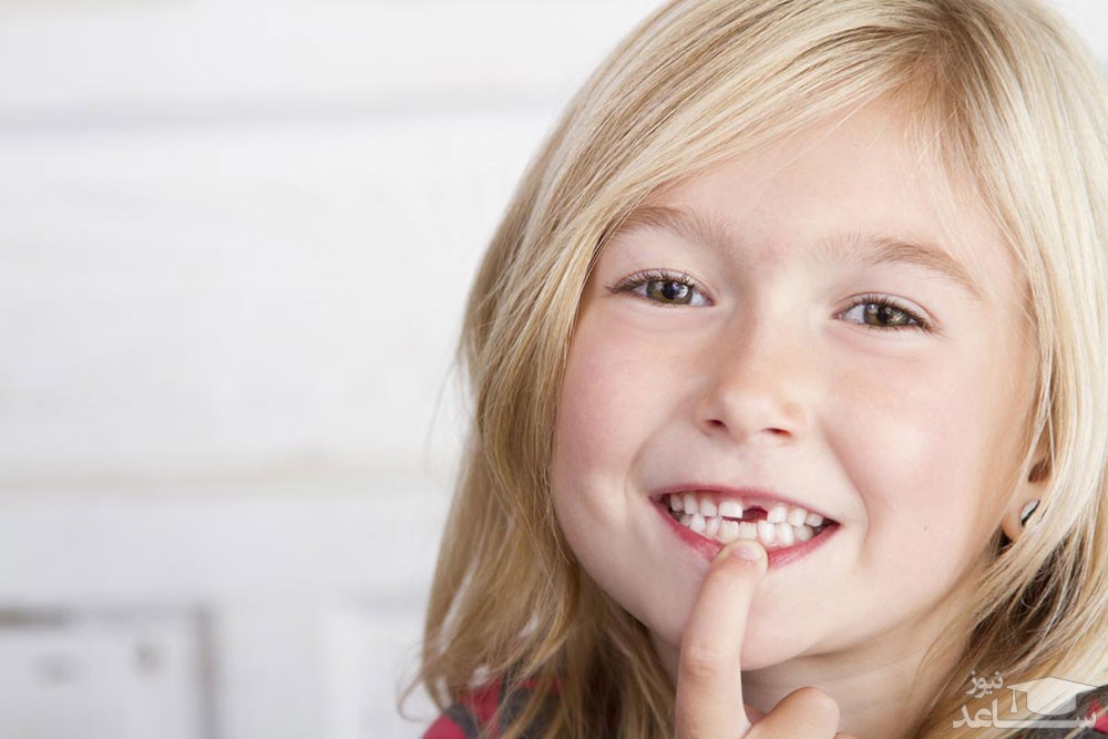 علائم وارد شدن آسیب به دندان شیری چیست و چگونه جلوگیری کنیم؟