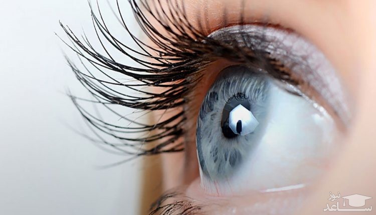 بیماری ضعف چشم و درمان آن