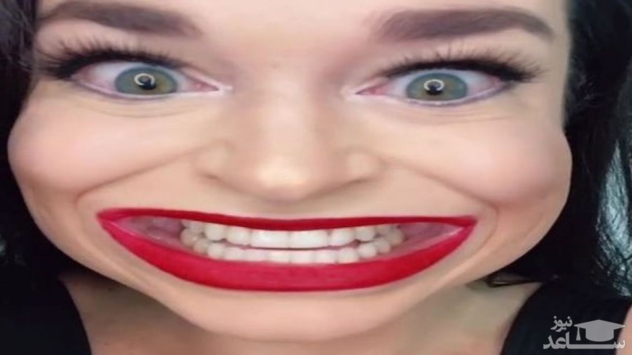 زنی با داشتن بزرگ ترین دهان دنیا رکورد دار گینس شد