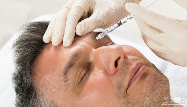 همه چیز در مورد ژل پروفایلو