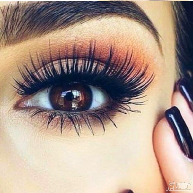 کاشت مژه و عوارض آن