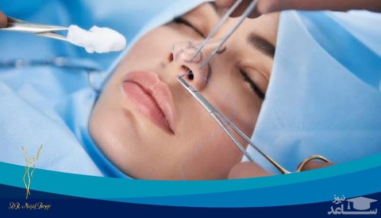 راهکارهای طلایی برای کسانیکه از عمل بینی خود راضی نیستند!