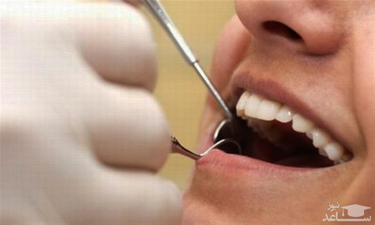 معاینه دندان