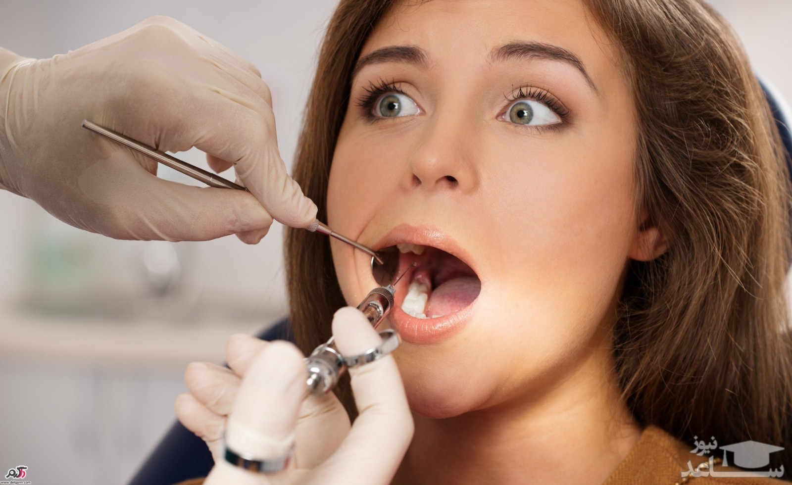 علت دندان درد بعد از پر کردن دندان و راههای درمان آن