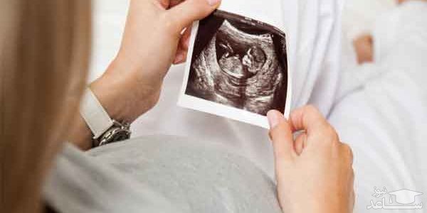 خطرات و عوارض رادیولوژی برای زن باردار و جنین