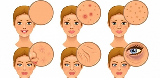 برای جلوگیری از پیری زودرس پوست و آکنه باید از مصرف چه مواد غذایی اجتناب کرد؟