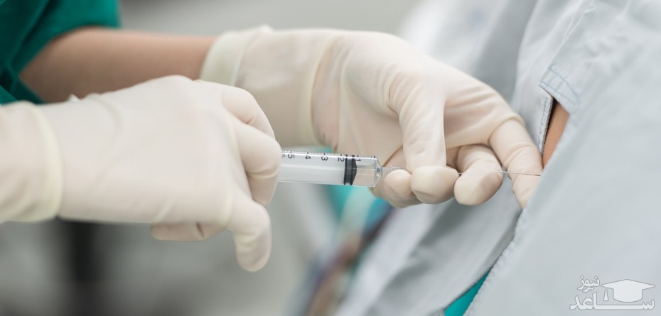 زایمان بدون درد چگونه انجام میشود؟