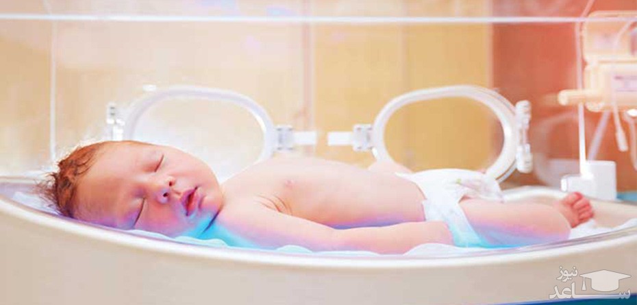 عوارض درمان زردی نوزاد با چهل تیغ کردن