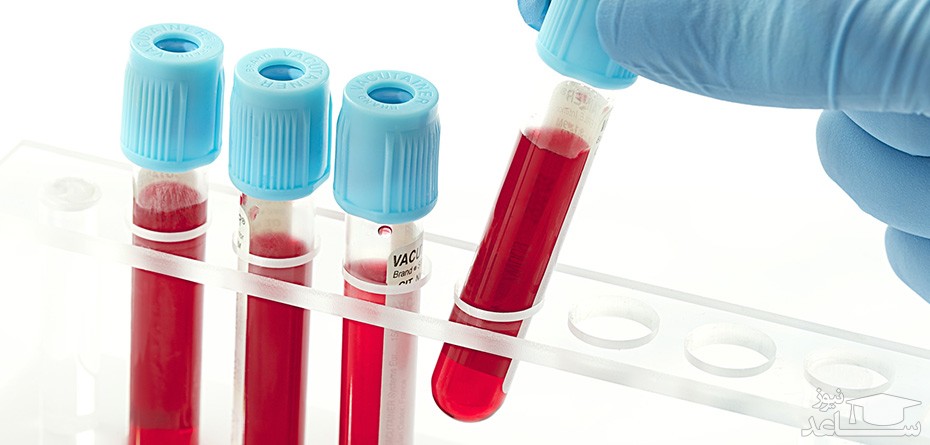 آزمایش های لازم قبل از باردار شدن