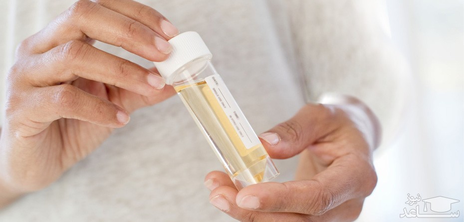 هشدار بارداری: دفع پروتئین در ادرار را نادیده نگیرید!