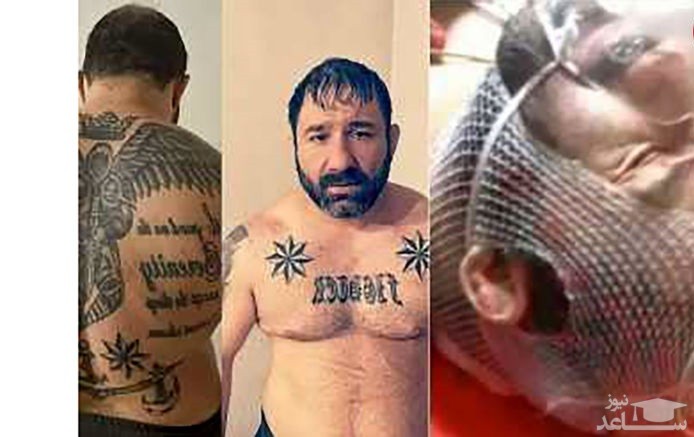 لبخند دوباره هانی کرده به زندگی / شرور تهران به هوش آمد