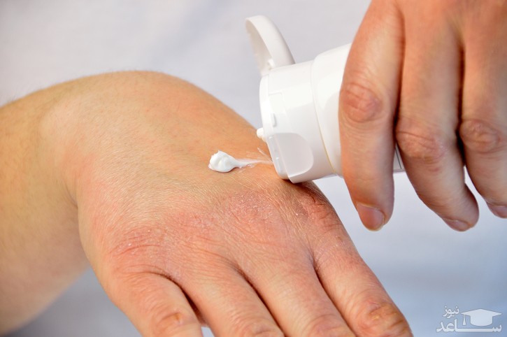 موارد منع مصرف و تداخل دارویی پماد پیمکرولیموس