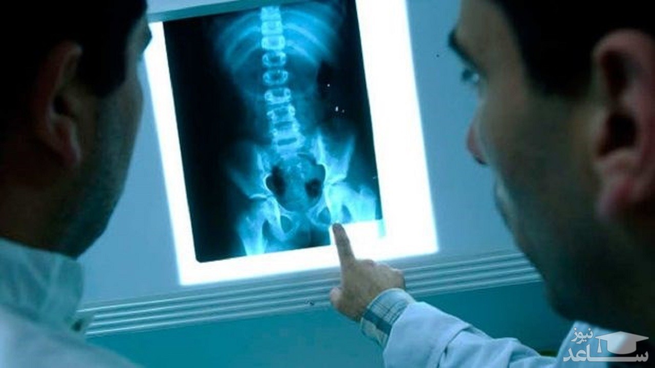 شناسایی سریع کووید-۱۹ با کمک یک مدل مبتنی بر اشعه ایکس و هوش مصنوعی