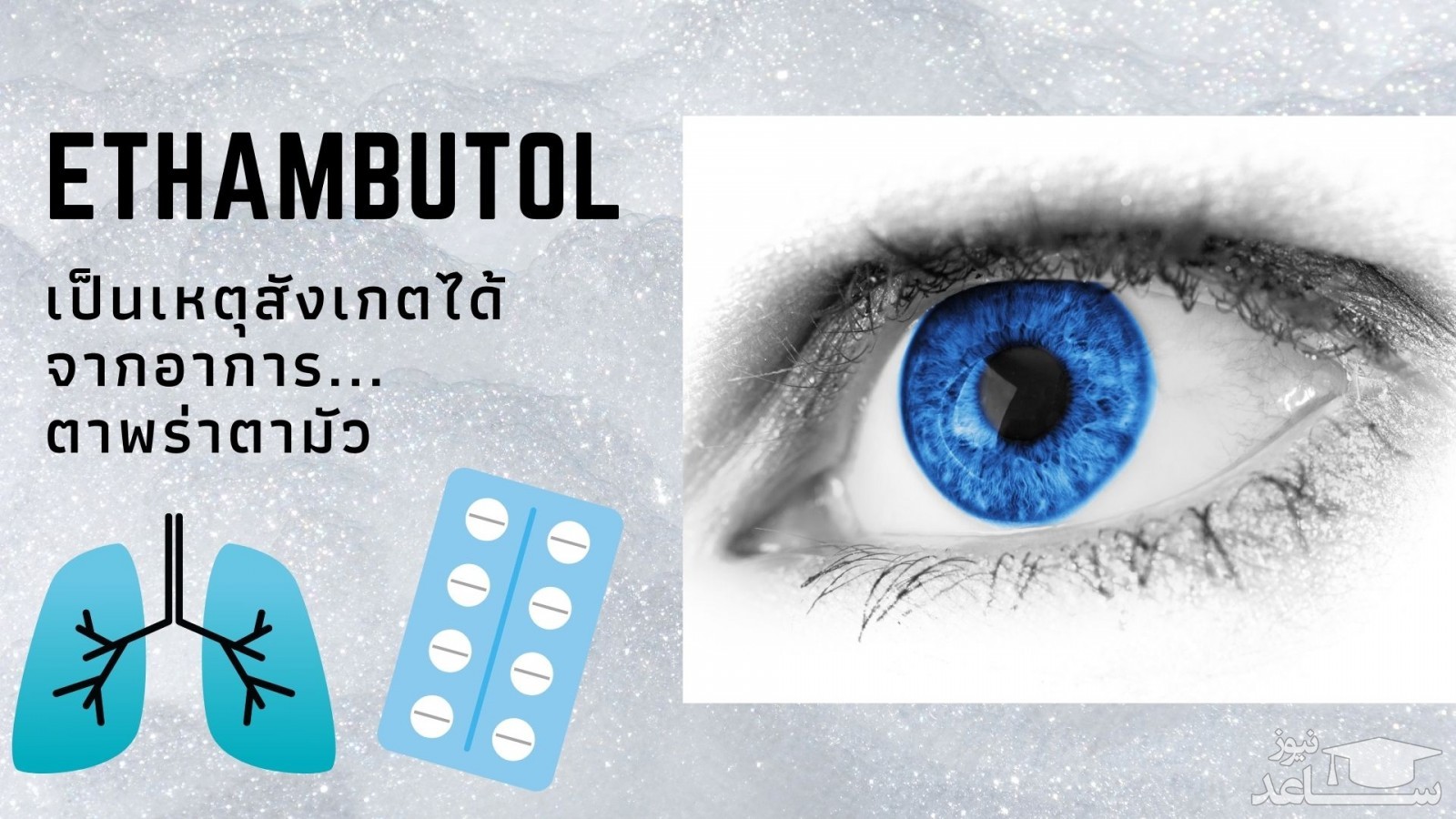 موارد منع مصرف و تداخل دارویی اتامبوتول