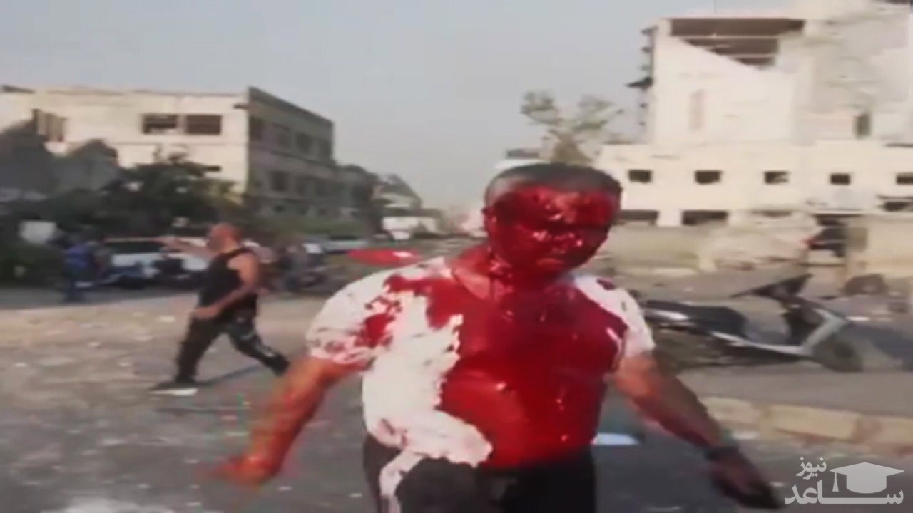 فیلمی دلخراش از زخمی‌های انفجار وحشتناک بندر بیروت