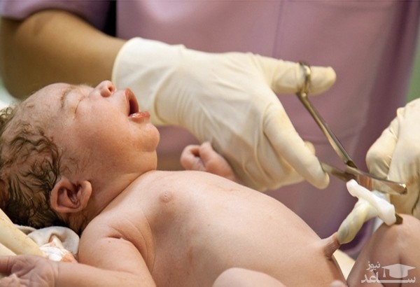 علل عفونت بند نوزاد و راههای درمان آن