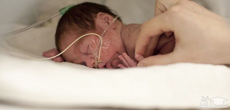 احتمال ناباروری در نوزادان پسر نارس