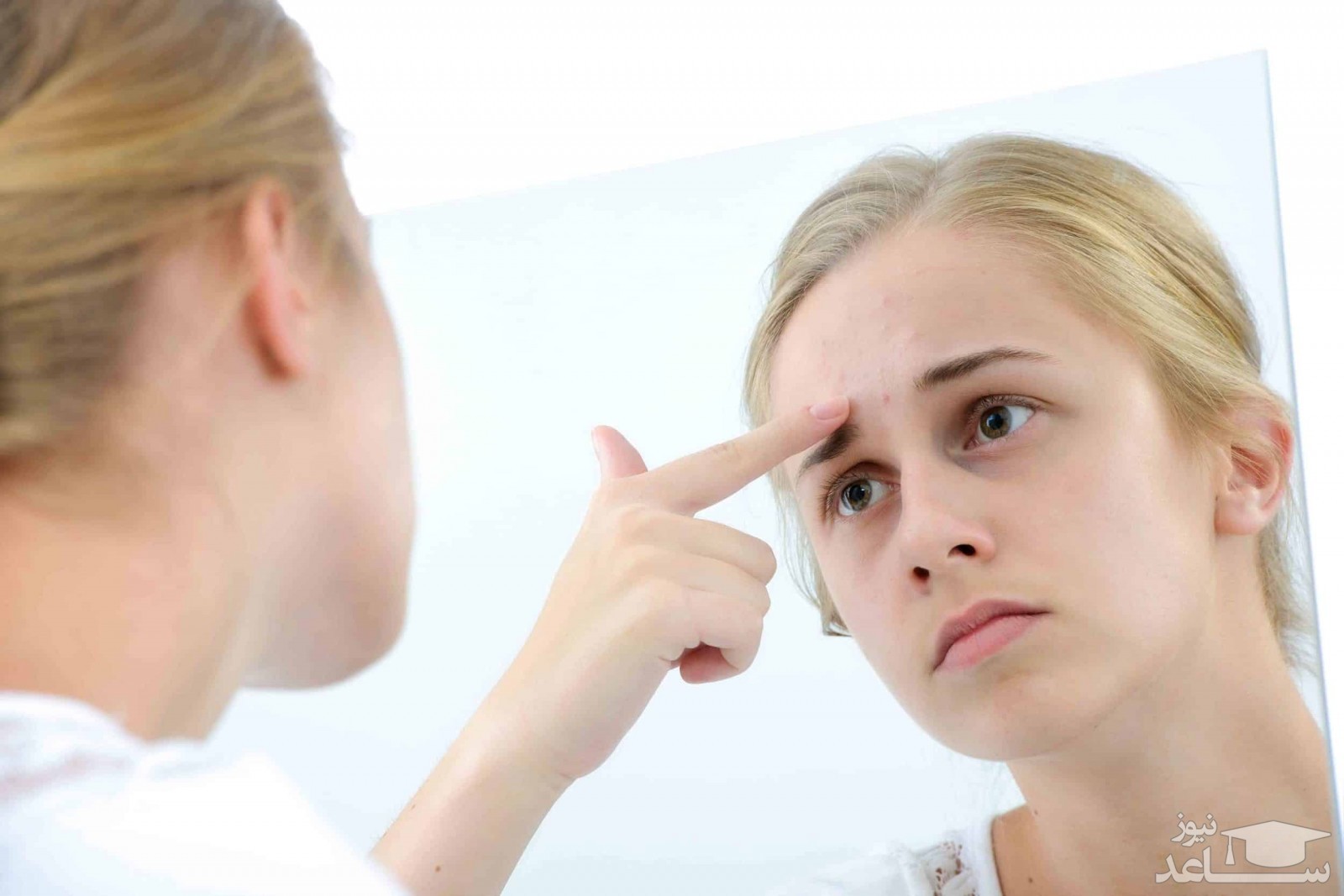 مؤثرترین راه‌ها برای درمان جوش صورت در طب سنتی
