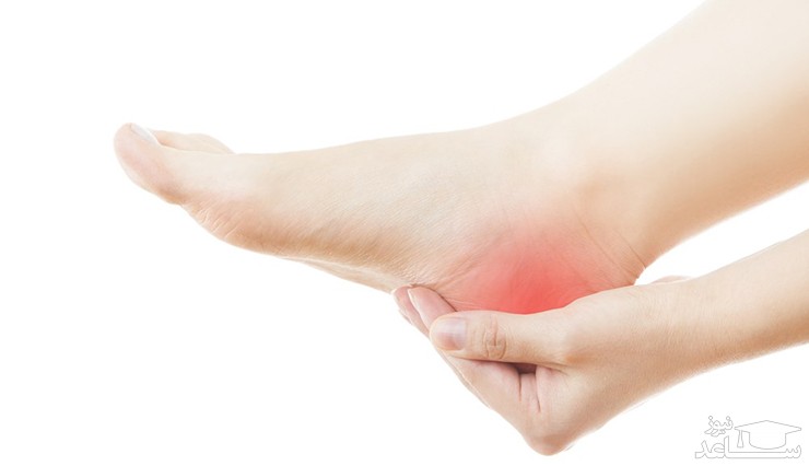 علت سوزش کف پا و راههای درمان آن