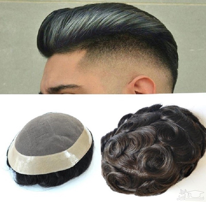 از پروتز مو تا ترمیم مو ... 0 تا 100 آنچه باید قبل از هر کاری بدانید!