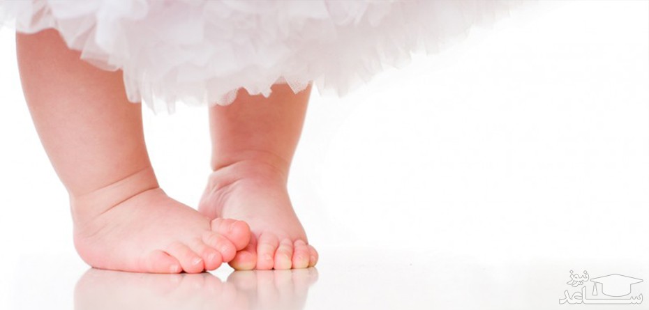 علت پارانتزی بودن پاهای نوزاد