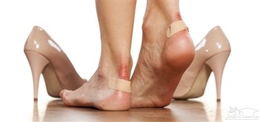 چرا پوستمان تاول می زند