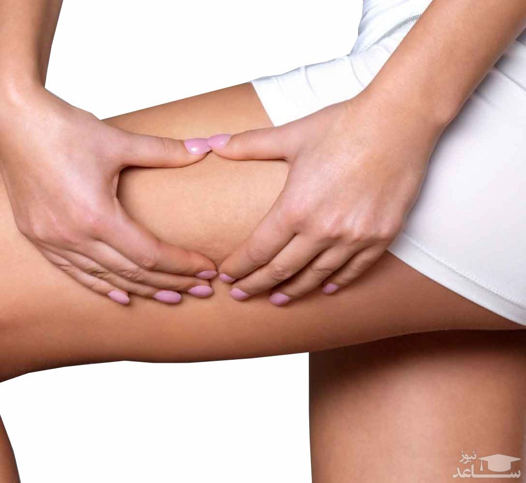 لیفت ران پا بدون جراحی امکان پذیر است ؟