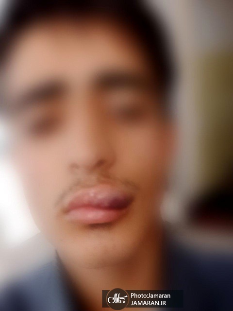 ضرب‌وشتم دانش‌آموز زنجانی توسط معلم ورزش